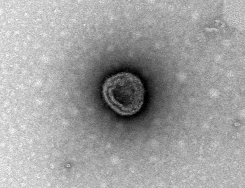 Succinate-loaded tumor cell–derived microparticles reprogram tumor-associated macrophage metabolism | Science Translational Medicine