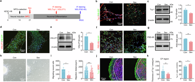 Human neuron chimeric mice reveal impairment of DVL-1-mediated neuronal migration by sevoflurane and potential treatment by rTMS