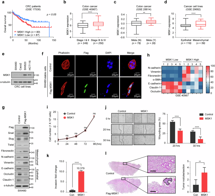MSK1 promotes colorectal cancer metastasis by increasing Snail protein stability through USP5-mediated Snail deubiquitination