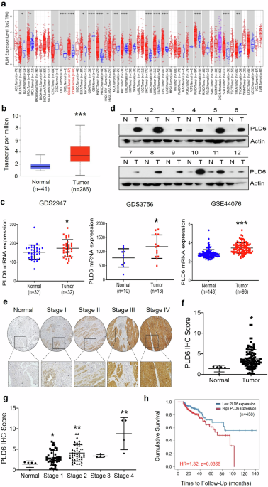 Phospholipase D6 activates Wnt/β-catenin signaling through mitochondrial metabolic reprogramming to promote tumorigenesis in colorectal cancer