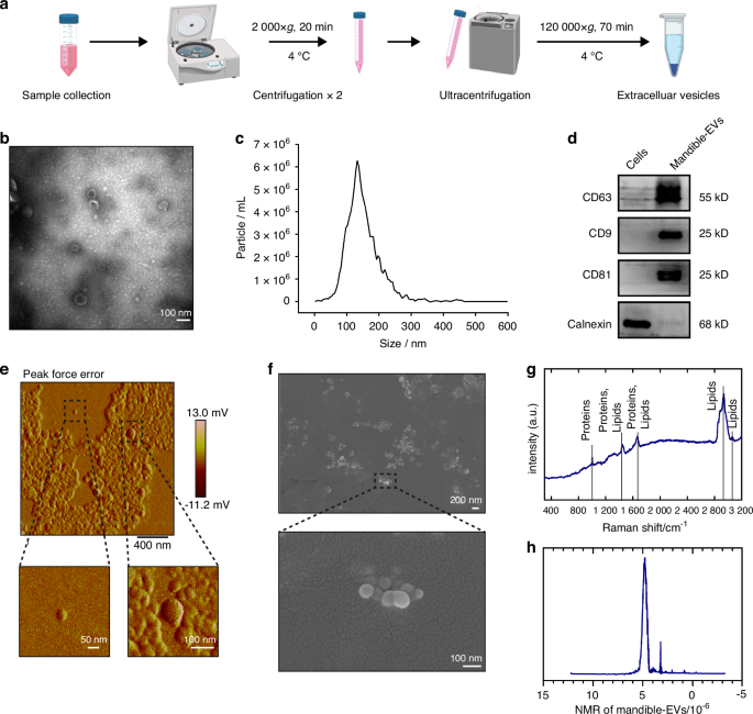 Mandible-derived extracellular vesicles regulate early tooth development in miniature swine via targeting KDM2B