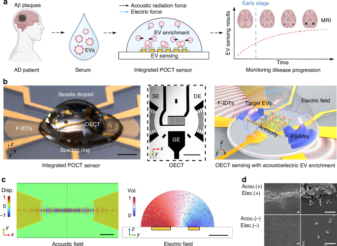 Extracellular vesicle-based point-of-care testing for diagnosis and monitoring of Alzheimer’s disease