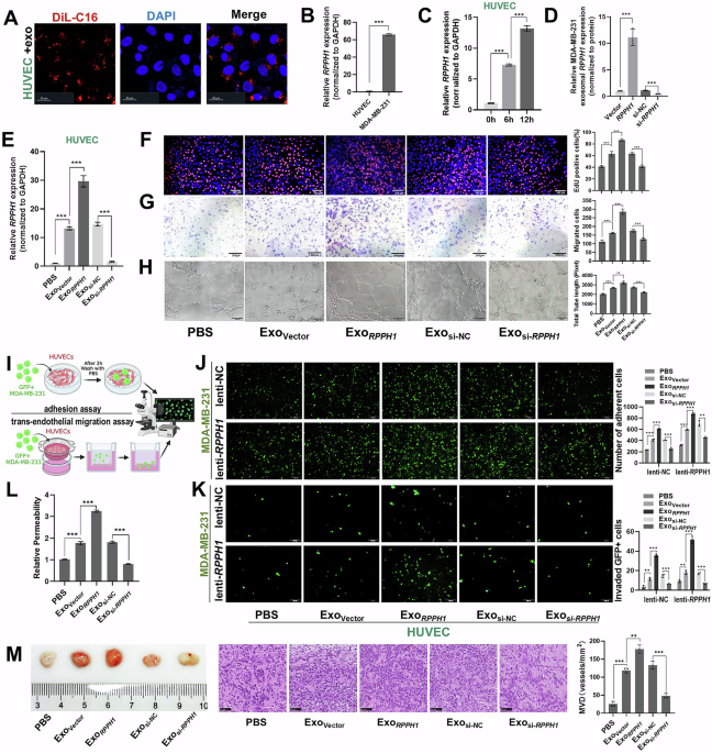 Correction: Hypoxia induced cellular and exosomal RPPH1 promotes breast cancer angiogenesis and metastasis through stabilizing the IGF2BP2/FGFR2 axis