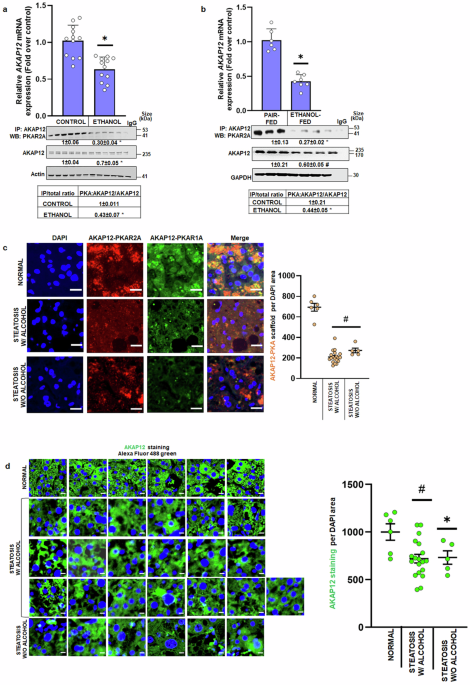 The AKAP12-PKA axis regulates lipid homeostasis during alcohol-associated liver disease