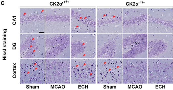 Correction: Small molecule induces mitochondrial fusion for neuroprotection via targeting CK2 without affecting its conventional kinase activity