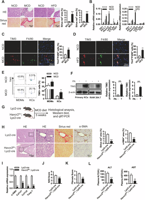 Macrophage miR-4524a-5p/TBP promotes β-TrCP -TIM3 complex activation and TGFβ release and aggravates NAFLD-associated fibrosis