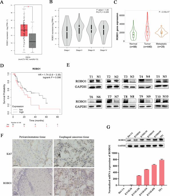 ROBO1 enhanced esophageal carcinoma cell radioresistance through accelerating G3BP2-mediated eIF3A degradation
