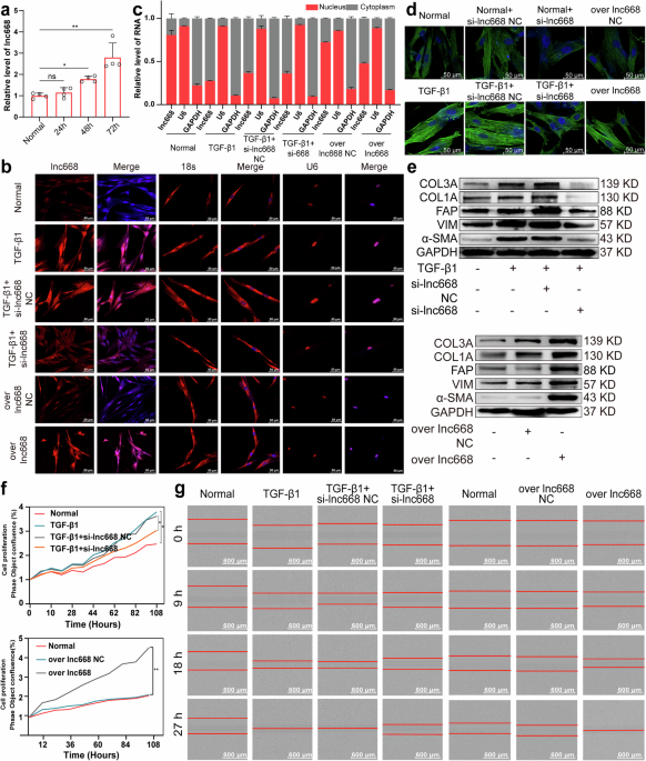 YTHDC1 phase separation drives the nuclear export of m6A-modified lncNONMMUT062668.2 through the transport complex SRSF3–ALYREF–XPO5 to aggravate pulmonary fibrosis