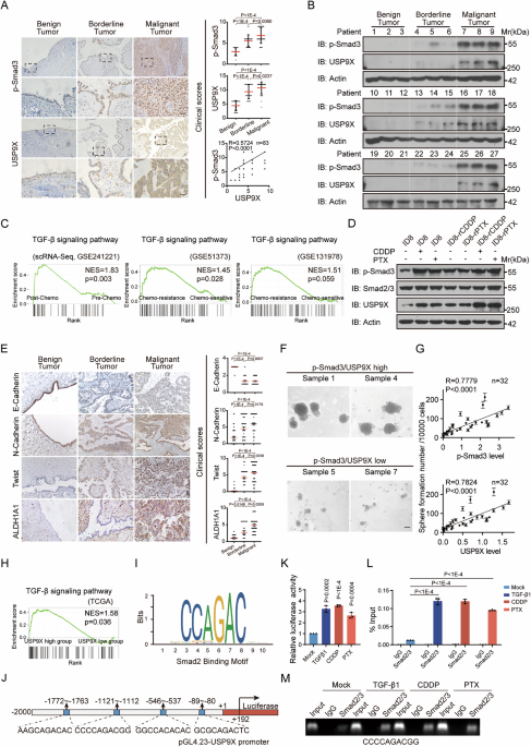 USP9X integrates TGF-β and hypoxia signalings to promote ovarian cancer chemoresistance via HIF-2α-maintained stemness