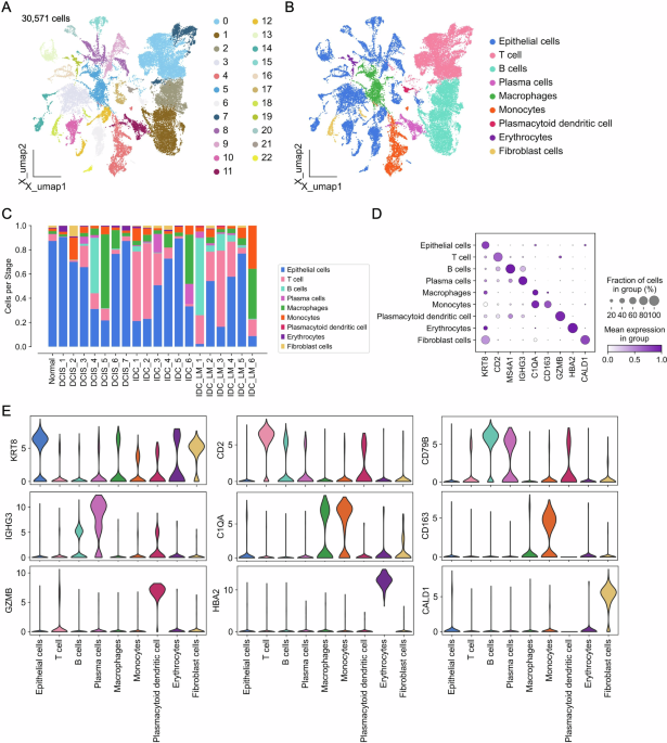 Development of a breast cancer invasion score to predict tumor aggressiveness and prognosis via PI3K/AKT/mTOR pathway analysis