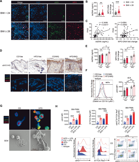 Saturated fatty acid-induced neutrophil extracellular traps contribute to exacerbation and biologic therapy resistance in obesity-related psoriasis
