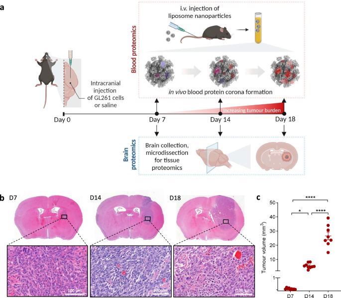 Plasma-to-tumour tissue integrated proteomics using nano-omics for biomarker discovery in glioblastoma