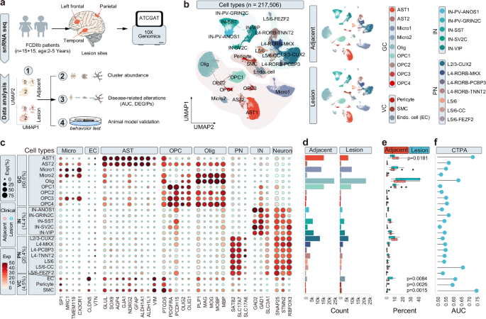 Transcriptomic and morphologic vascular aberrations underlying FCDIIb etiology