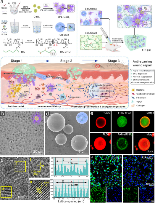 A dynamically phase-adaptive regulating hydrogel promotes ultrafast anti-fibrotic wound healing