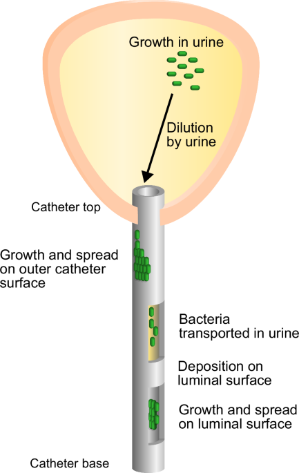 Different factors control long-term versus short-term outcomes for bacterial colonisation of a urinary catheter
