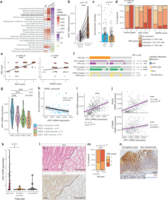 p53 protein degradation redefines the initiation mechanisms and drives transitional mutations in colorectal cancer