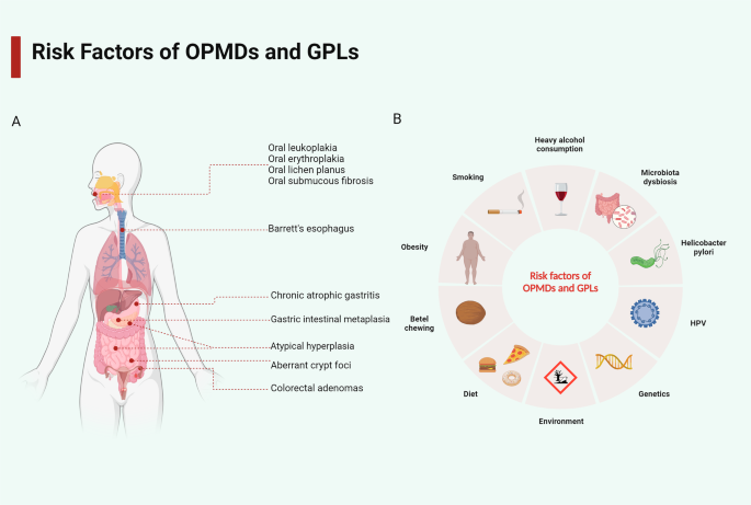 Probiotics and prebiotics: new treatment strategies for oral potentially malignant disorders and gastrointestinal precancerous lesions