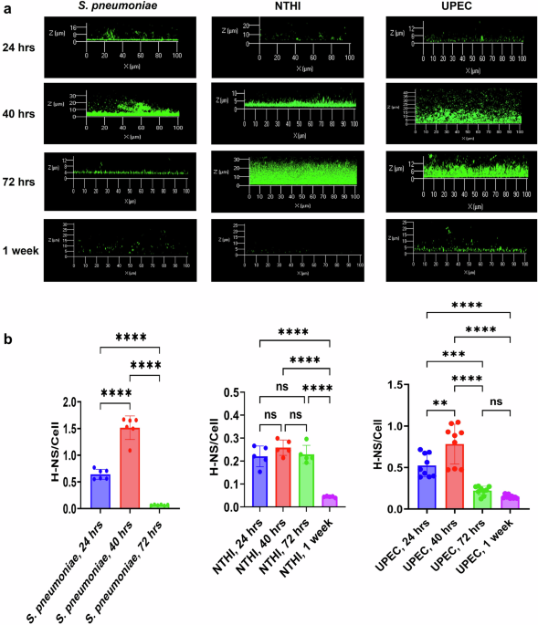Bacterial biofilm-derived H-NS protein acts as a defense against Neutrophil Extracellular Traps (NETs)