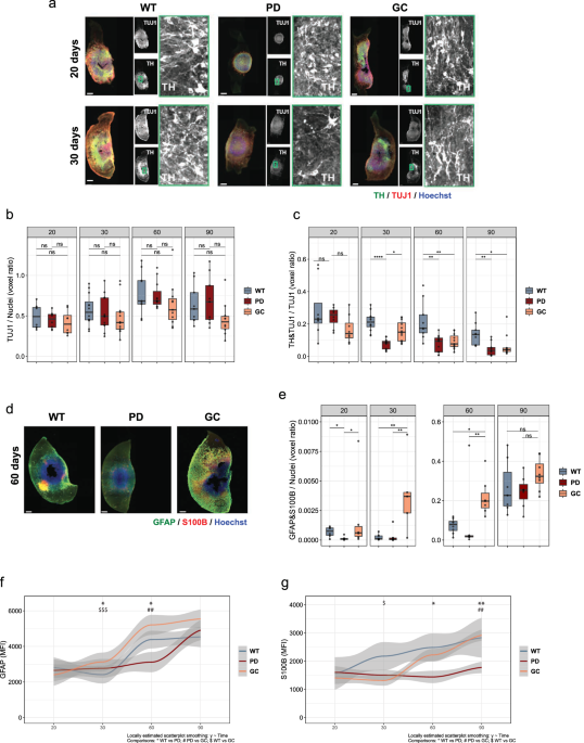 MIRO1 mutation leads to metabolic maladaptation resulting in Parkinson’s disease-associated dopaminergic neuron loss