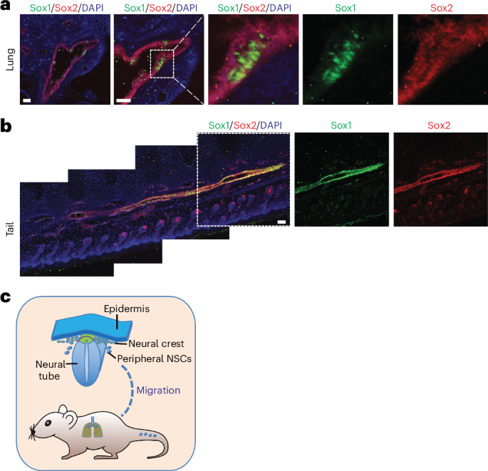 Peripheral neural stem cells from the neural tube contribute to multi-organ neurogenesis