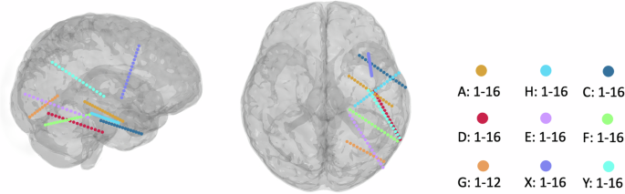 VocalMind: A Stereotactic EEG Dataset for Vocalized, Mimed, and Imagined Speech in Tonal Language