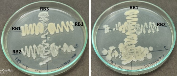 Statistical optimization of process variables for improved poly(ethylene terephthalate) plastic degradation by a rhizospheric bacterial consortium