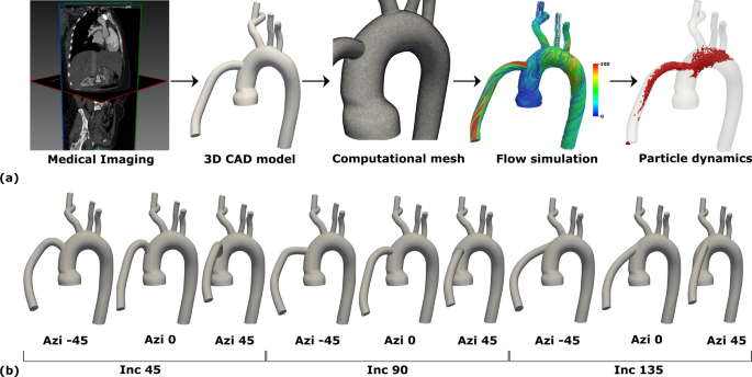 Understanding embolus transport and source to destination mapping of thromboemboli in hemodynamics driven by left ventricular assist device