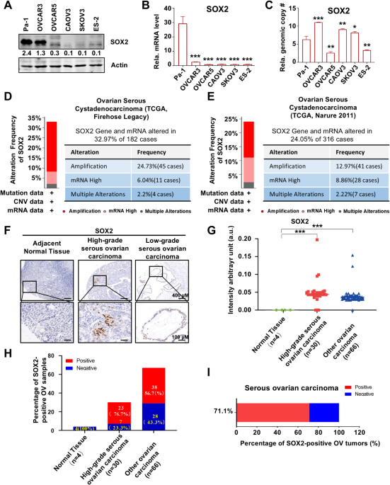 AKT1 as a therapeutic target for platinum-resistant SOX2 positive ovarian cancer cells