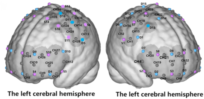 Effects of Tai Chi on executive function, single-leg dynamic balance, and brain functional connectivity in older adults