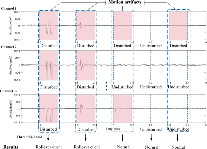 CHMMConvScaleNet: a hybrid convolutional neural network and continuous hidden Markov model with multi-scale features for sleep posture detection