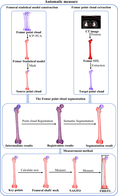 Automatic measurement of proximal femoral morphological parameters using point cloud semantic segmentation technology