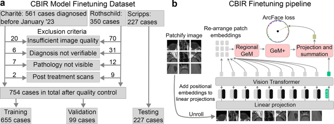 Content-based image retrieval assists radiologists in diagnosing eye and orbital mass lesions in MRI