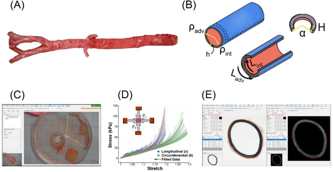 Variations in stiffness and structure of the human aorta along its length