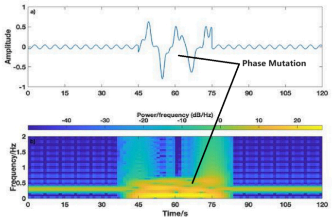 Separation of thoracic and abdominal measurements in neonatal vital sign monitoring using radar vision fusion system
