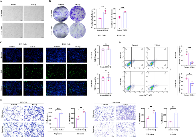 Static magnetic field inhibits epithelial mesenchymal transition and metastasis of glioma