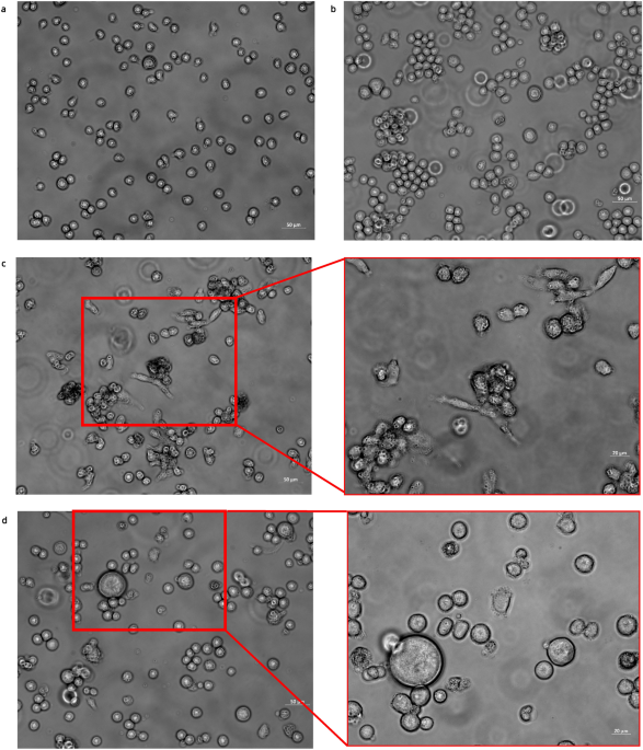Safety profile of sikamat virus and its oncolytic potential in leukemic cells and cancer stem cells