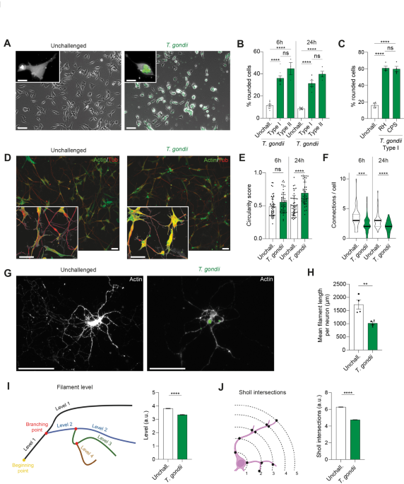 Cytoskeletal alterations in neuronal cells implicate Toxoplasma gondii secretory machinery and host microRNA-containing extracellular vesicles