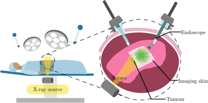Image quality evaluation of imaging skins, a novel stretchable X-ray detector for intraoperative tumour imaging