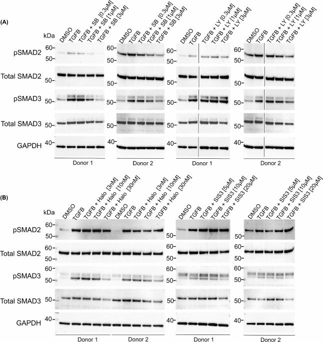 Preclinical validation of TGFβ inhibitors as a novel therapeutic strategy for post-traumatic heterotopic ossification