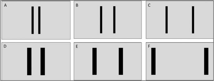 Speed-accuracy trade-offs in action perception, motor imagery, and execution of hand movements in autistic and non-autistic adults