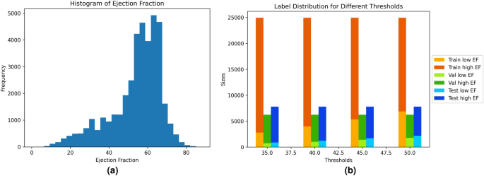 AI analysis for ejection fraction estimation from 12-lead ECG