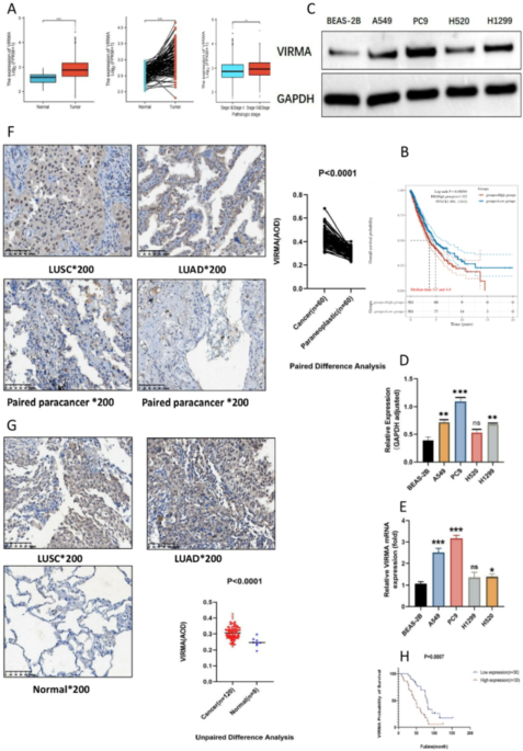 VIRMA promotes NSCLC progression by modifying ADAR m6A and increasing the activity of the TGF-β signaling pathway