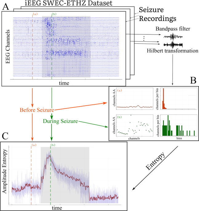 Amplitude entropy captures chimera resembling behavior in the altered brain dynamics during seizures