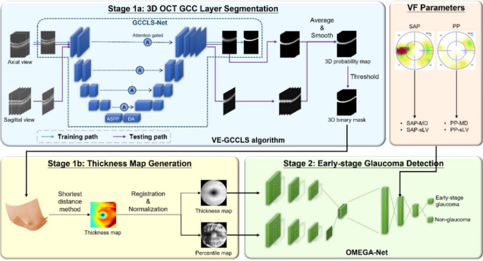 Diagnosis of early glaucoma likely combined with high myopia by integrating OCT thickness map and standard automated and Pulsar perimetries