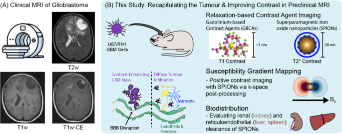 Enhanced detection of glioblastoma vasculature with superparamagnetic iron oxide nanoparticles and MRI