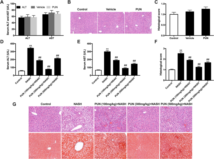 Punicalagin relieves hepatic injury by antioxidation and enhancement of autophagy in diet-induced nonalcoholic steatohepatitis