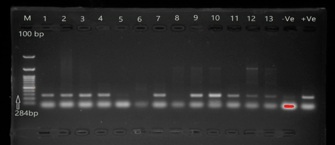 Antibiotic residues correlate with antibiotic resistance of Salmonella typhimurium isolated from edible chicken meat