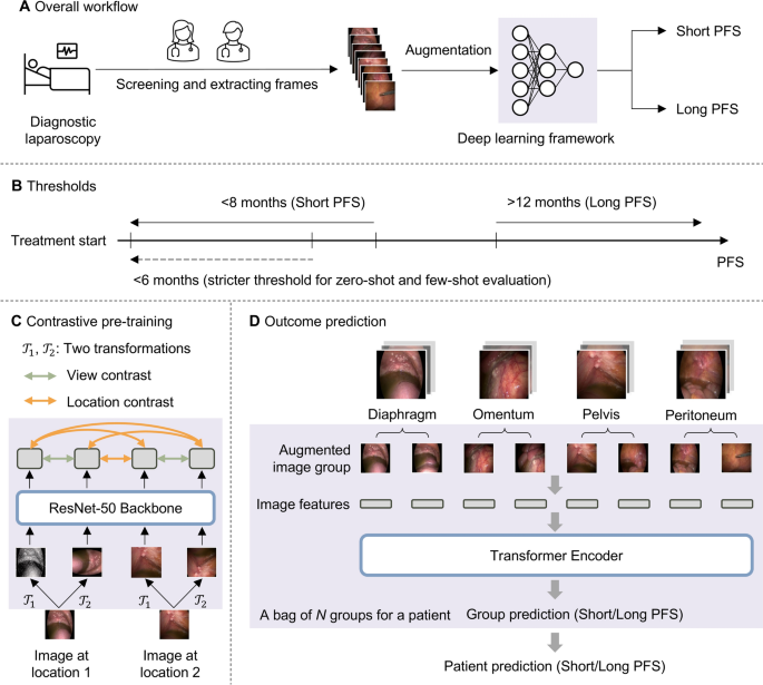 A pioneering artificial intelligence tool to predict treatment outcomes in ovarian cancer via diagnostic laparoscopy