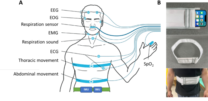 Detection of sleep apnea using smartphone-embedded inertial measurement unit