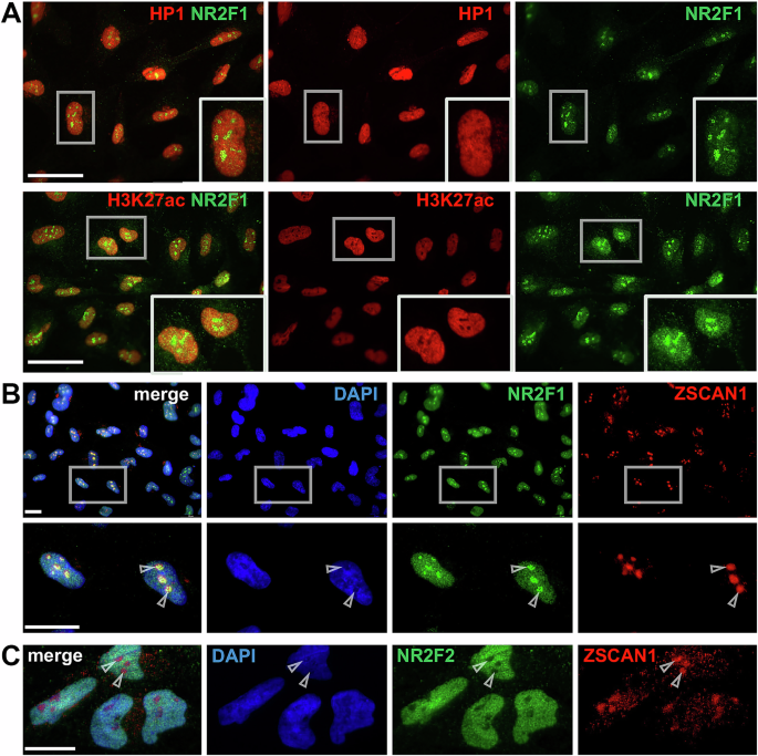Unravelling the conundrum of nucleolar NR2F1 localization using antibody-based approaches in vitro and in vivo